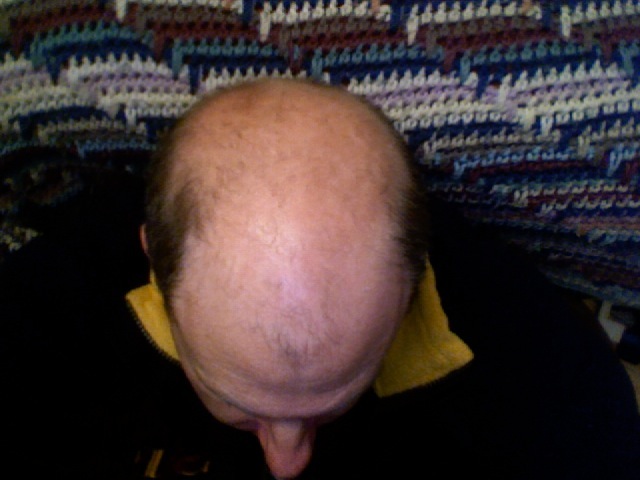 Soubor:Bald head.jpg