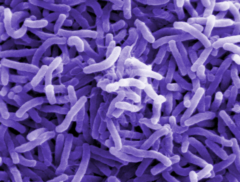 Soubor:Cholera bacteria (Vibrio cholerae)-Flickr.jpg