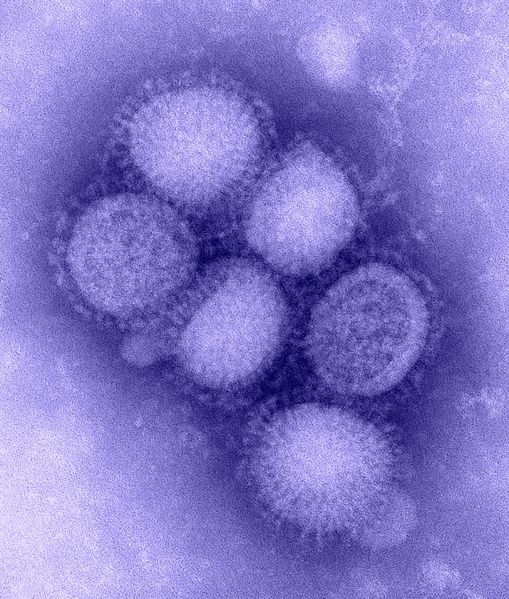 Soubor:H1N1 influenza virus.jpg